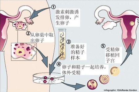 代怀生子机构